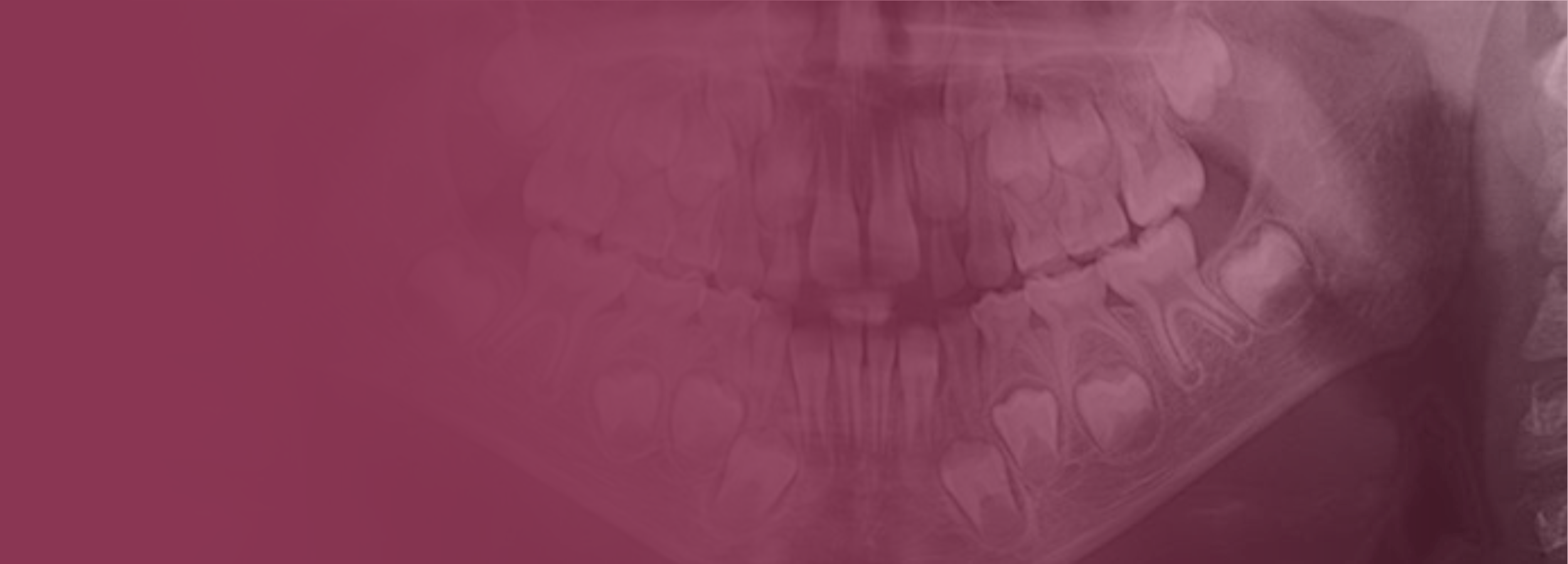 Radiografias Extrabucais