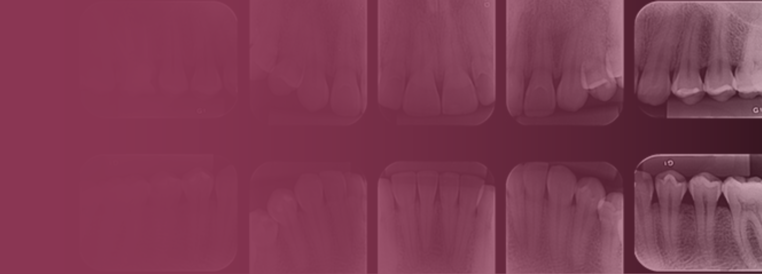 Radiografias Intrabucais